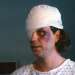 Kevin Van Hentenryck in final bandage makeup.